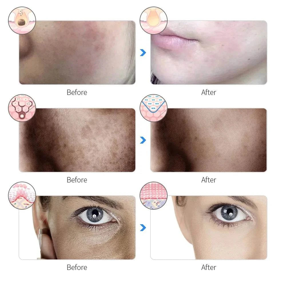 LED Light Therapy Mask for Skin Rejuvenation and Anti- AgingRevitalize your skin with our LED Light Therapy Mask! This innovative mask uses cutting-edge LED light therapy to target signs of aging, boost collagen production, aShop All I WantShop All I WantLED Light Therapy Mask