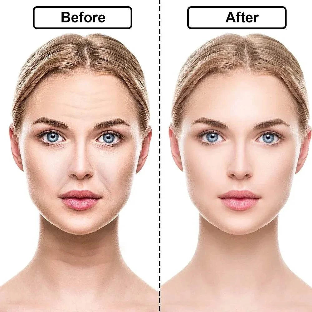 ✨ Reusable Silicone Wrinkle Removal Stickers – Face, Forehead, Neck, ESmooth and rejuvenate your skin with Reusable Silicone Wrinkle Removal Stickers. These versatile patches target wrinkles on the face, forehead, neck, and eyes for efShop All I WantShop All I WantReusable Silicone Wrinkle Removal Stickers