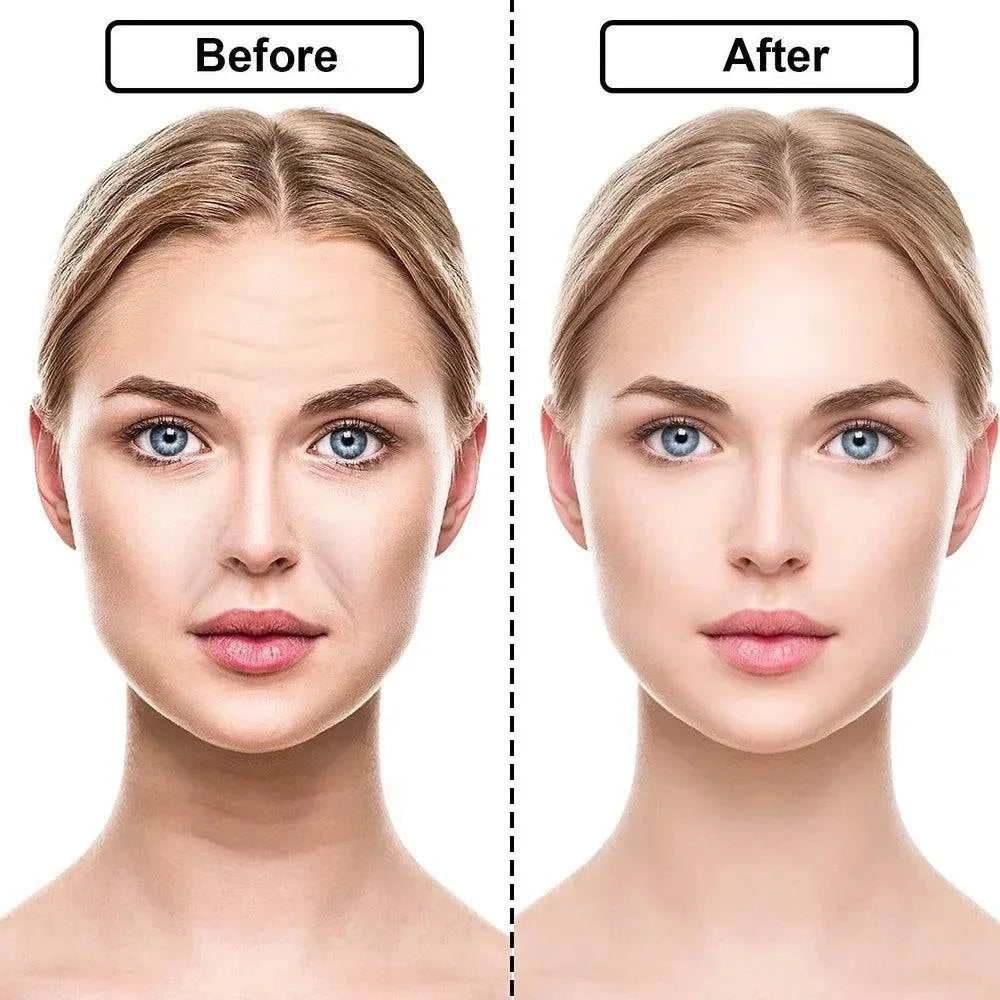 ✨ Reusable Silicone Wrinkle Removal Stickers – Face, Forehead, Neck, ESmooth and rejuvenate your skin with Reusable Silicone Wrinkle Removal Stickers. These versatile patches target wrinkles on the face, forehead, neck, and eyes for efShop All I WantShop All I WantReusable Silicone Wrinkle Removal Stickers
