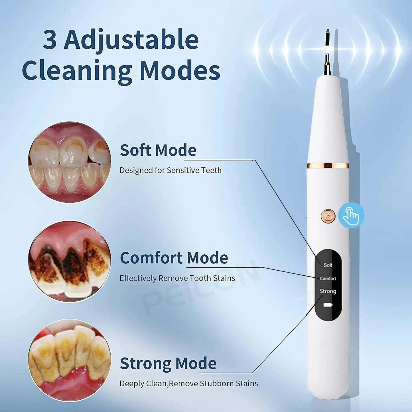 Shop All I Want SHOP ALL I WANT Ultrasonic Dental Calculus Remover